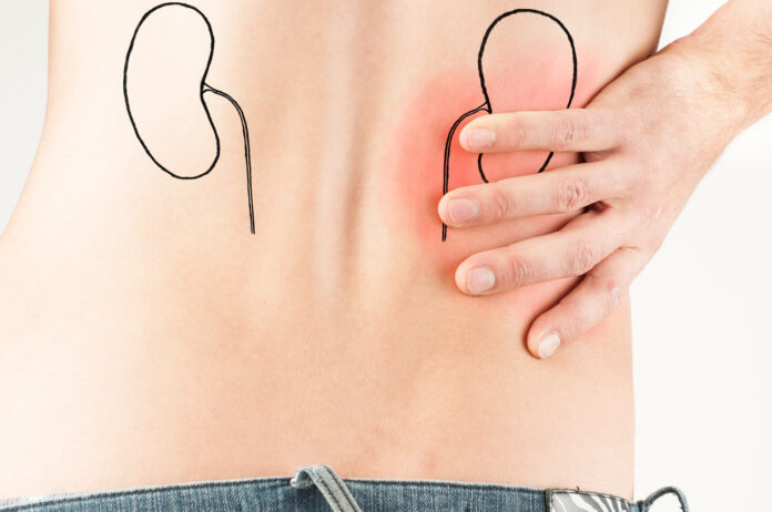 renal colic - male adult - kidney disease